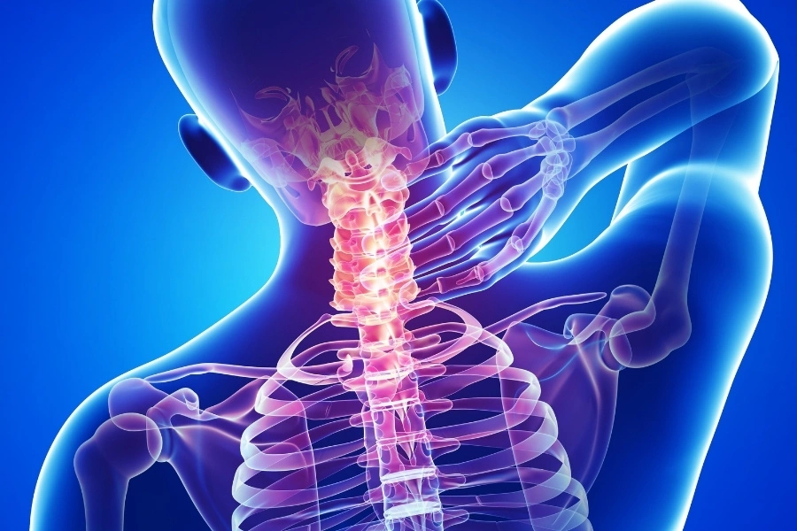 Tìm hiểu nguyên nhân đau cổ vai gáy